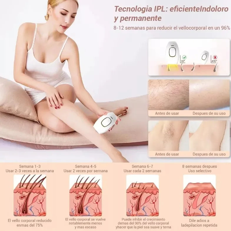 DEPILADORA LÁSER TOTAL IPL 110V